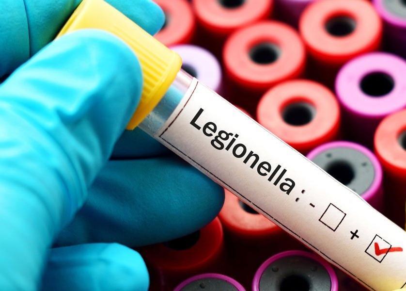 Legionella Testing and Analysis Kits – Envirochem Analytical ...